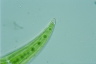 Closterium moniliferum