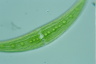 Closterium moniliferum