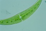 Closterium moniliferum