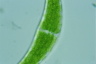 Closterium moniliferum