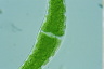 Closterium moniliferum