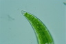 Closterium moniliferum