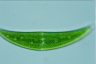 Closterium moniliferum