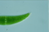 Closterium moniliferum