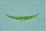 Closterium dianae