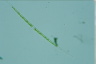 Closterium idiosporum