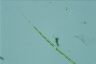 Closterium idiosporum