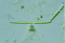 Closterium toxon