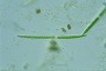 Closterium toxon