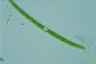 Closterium toxon