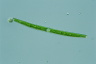 Closterium toxon