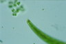 Closterium nematodes