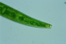 Closterium costatum