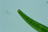 Closterium costatum