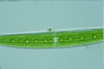 Closterium acerosum