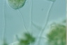 Vorticella