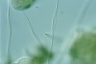 Vorticella