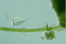 Vorticella