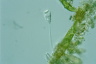 Vorticella