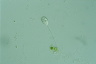 Vorticella