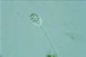 Vorticella