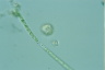 Pterocystis