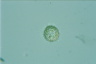 Choanocystis