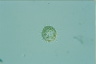 Choanocystis