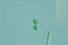 Glaucocystis nostochinearum