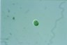 Chroococcus