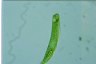 Euglena oxyuris