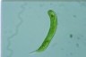 Euglena oxyuris