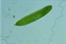 Euglena spirogyra