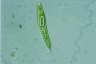 Euglena spirogyra