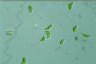 Euglena