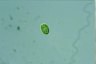 Euglena