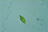 Euglena Lepocinclis