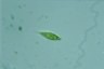 Euglena Lepocinclis