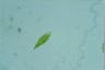 Euglena Lepocinclis