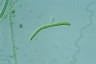 Ophiocytium