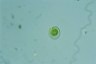 Dysmorphococcus punctatus