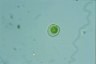 Dysmorphococcus punctatus