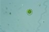 Dysmorphococcus punctatus