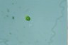 Oocystis