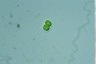 Oocystis