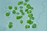 Oocystis