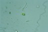 Apatococcus