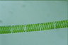 Spirogyra