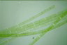 Spirogyra