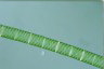 Spirogyra